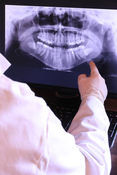 Best Emergency Tooth Extraction in Manvel, TX